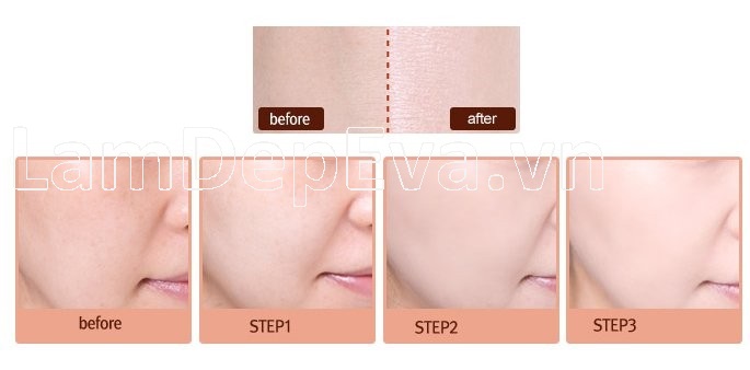 LaMarine Pure Perfector Tinh Chất Nhau Thai Cừu Làm Trắng Da 